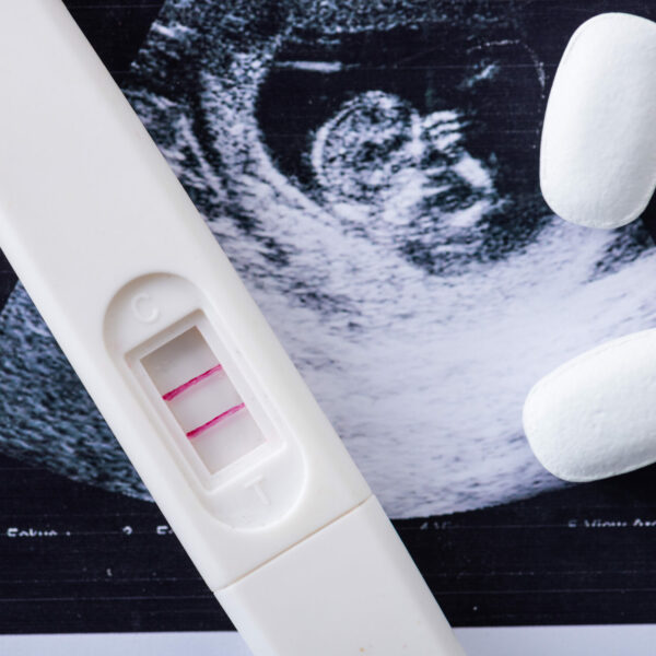 close-up-of-pills-and-pregnancy-test-on-ultrasound
