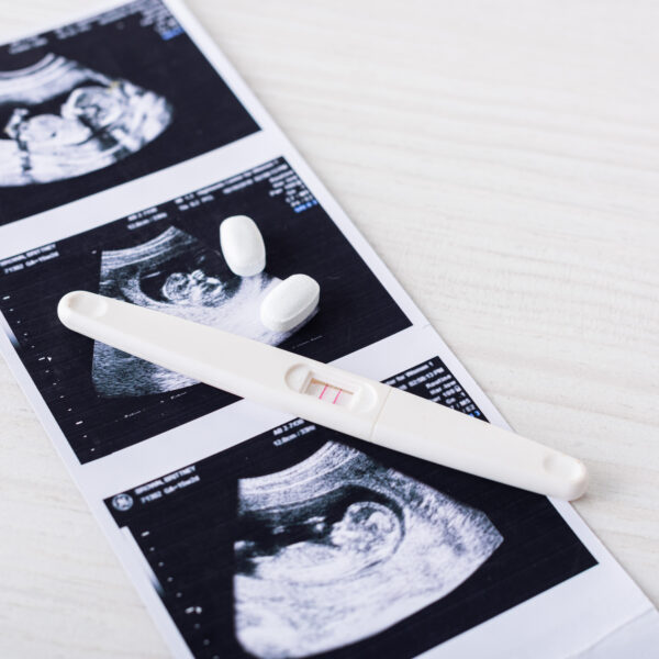 pills-and-pregnancy-test-on-ultrasound