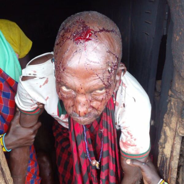 Maasai-person-bleeding-after-attack